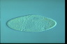 Paramecium caudatum, intact cells