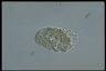 Paramecium caudatum, macronuclear inclusion body