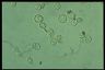 Paramecium caudatum, macronuclear inclusion body