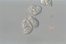 Paramecium caudatum, macronuclear inclusion body