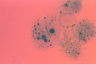 Paramecium caudatum, macronuclear inclusion body