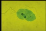 Paramecium caudatum, macronuclear inclusion body