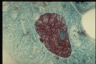 Paramecium caudatum, macronuclear inclusion body