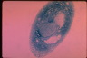 Paramecium caudatum, macronuclear inclusion body