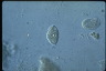 Paramecium caudatum, macronuclear inclusion body